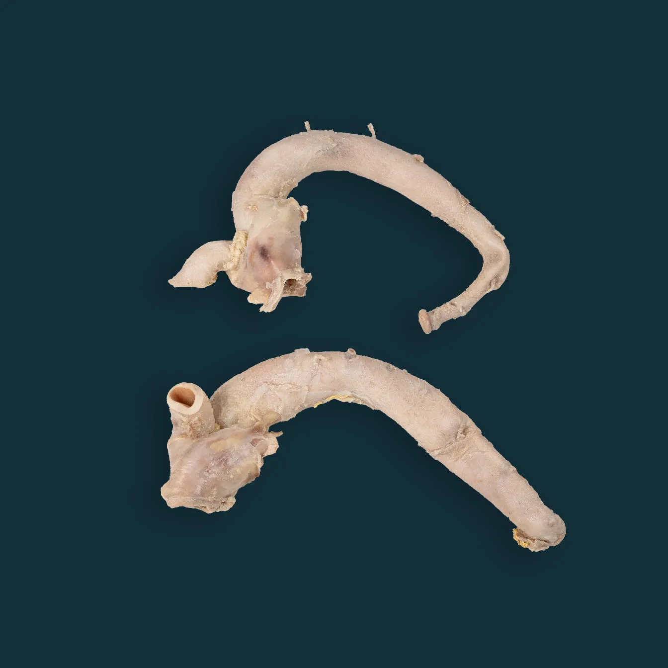 Tube aorta